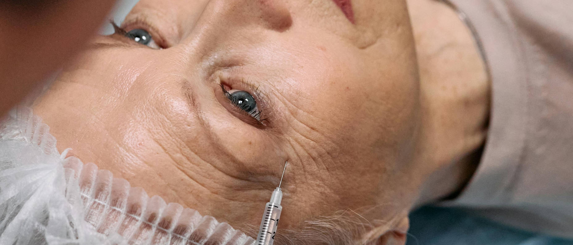 Botox Behandlung in der Laserpraxis Straubing